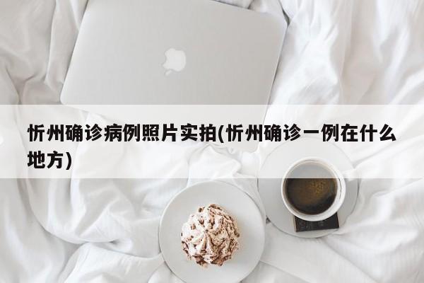 忻州确诊病例照片实拍(忻州确诊一例在什么地方)